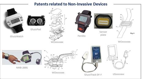 Non-Invasive Glucose Monitoring Patent Landscape 2015 - KnowMade