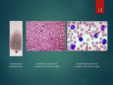 Peripheral Blood Smear Ppt