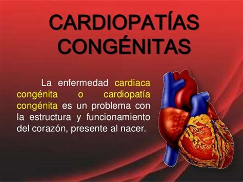 Cardiopatias Congénitas