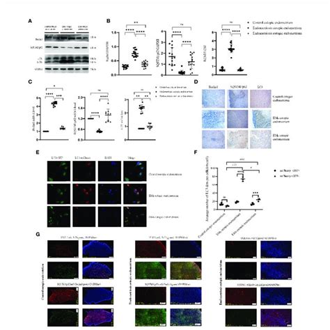 MST1 Is Downregulated In Endometriosis Related Peritoneal Macrophages