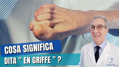 Cosa Significa Dita En Griffe Dott Andrea Scala YouTube