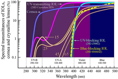 Ultra Violet Superpower After Cataract Surgery With Crystalens