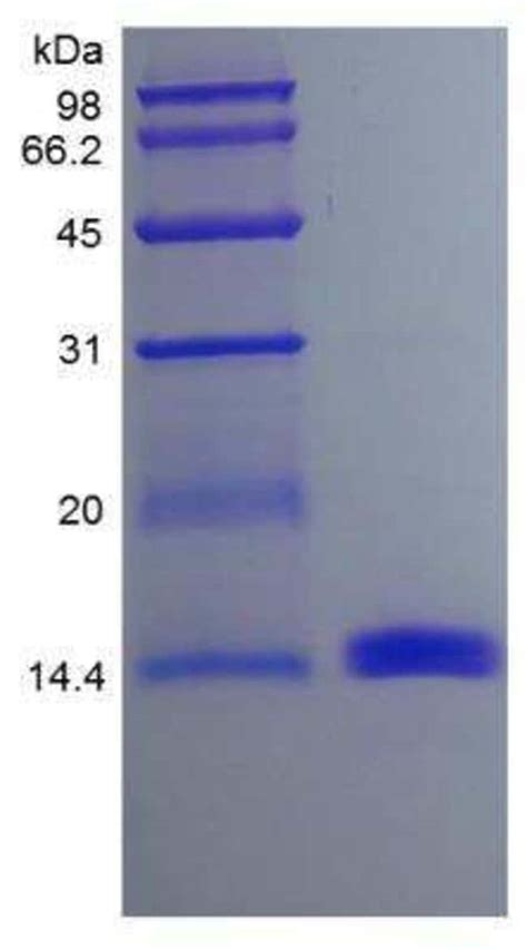 Novus Biologicals Recombinant Mouse Gm Csf Protein Fisher Scientific