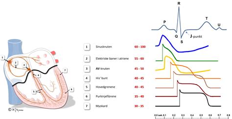 Index Of Elaring Fag Hjertesykdommer Spl Ekg Del Images