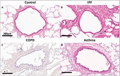 Lung Extracellular Matrix Encyclopedia Mdpi