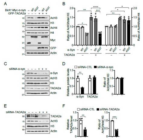 Ijms Free Full Text α Synuclein A53t Binds To Transcriptional