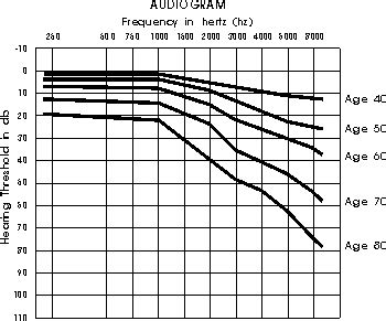 The Bizarre World of Extreme Reverse-Slope Hearing Loss (or Low ...