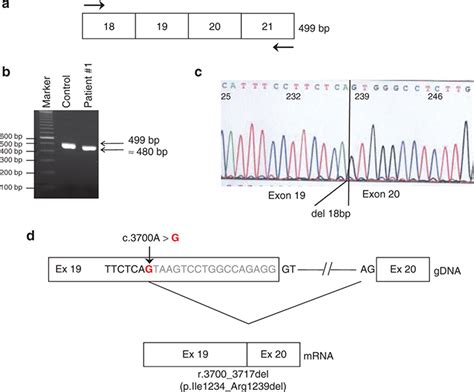 Aberrant Splicing Due To C 3700 A G Mutation In Cystic Fibrosis