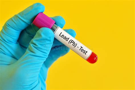 Lead Test Stock Image Image Of Hematology Toxic Result 70336745