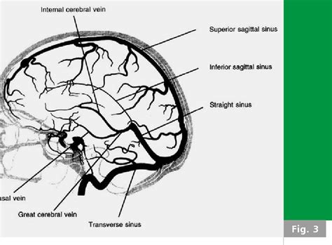 Figure 1 From Cerebral Venous Sinus Thrombosis In A Preterm Infant