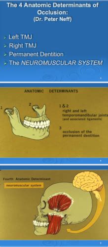 Anatomy Of The TMJ Muscles Of Mastication An Intro To The Study Of