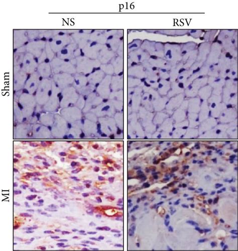 Rsv Decreased Expression Of Senescence Markers In The Mouse Heart