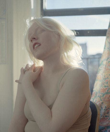 Albino Girl Naked Telegraph