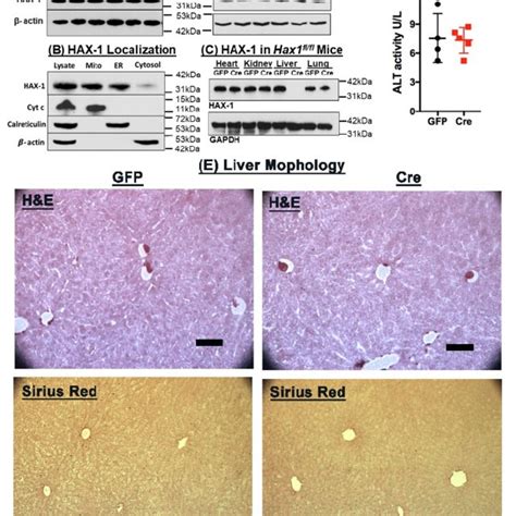 Hepatic HAX 1 Inactivation Activates FXR And Reduces SREBP 1 Genes In