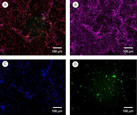 Stemdiff Midbrain Neuron Differentiation Kit Stemcell Technologies