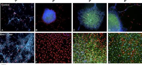 Bmi 1 Cooperates With Foxg1 To Maintain Neural Stem Cell Self Renewal In The Forebrain