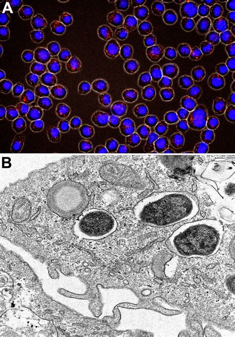 Cell And Tissue Tropism Of Brucella Spp Infection And Immunity