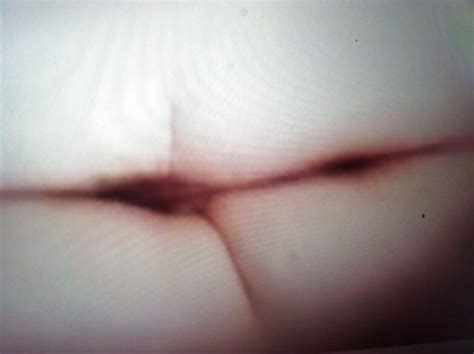 My Bbw Hairy Wife Porn Pics PICTOA