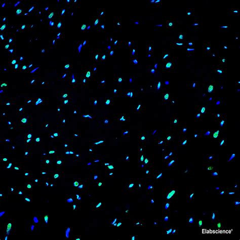 One Step TUNEL In Situ Apoptosis Kit Green AF488 Elabscience