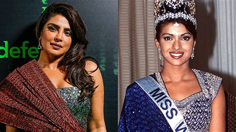 Priyanka Chopra Says Botched Plastic Surgery Caused A Depression