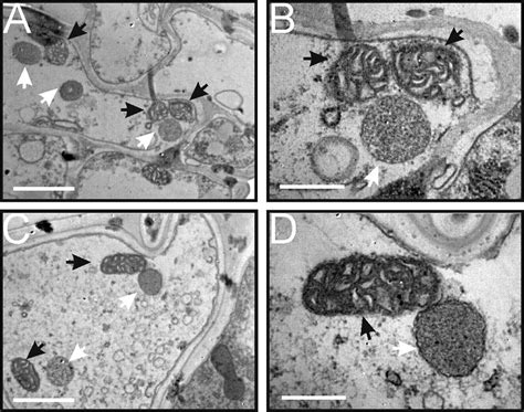 Mitochondrial Ultrastructure In Yta And Ytb Transmission Electron Download Scientific Diagram