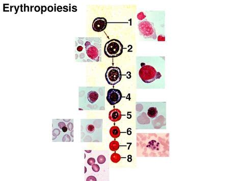 10+ Hematology Slides ideas in 2020 | hematology, medical lab ...