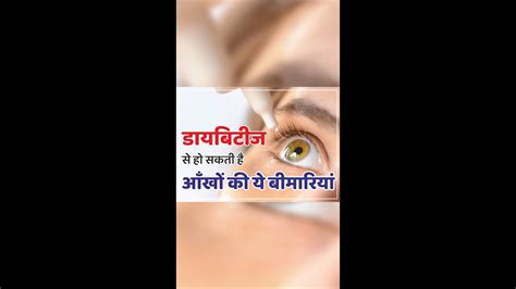 Diabetic Retinopathy Ayurvedic Eye Treatment Dr Basu Eye Hospital Youtube