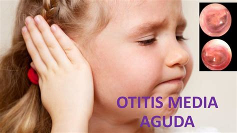 Otitis Media Aguda Sinusitis Faringoamigdalitis Aguda Faa Hot Sex Picture