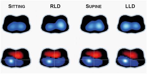 Axial electrical impedance tomography (EIT) imaging performed in four ...