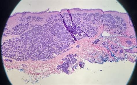 Jerad Gardner MD On Twitter RT Sunpungi Another Case To Discuss