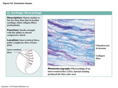 Fibrocartilage Location