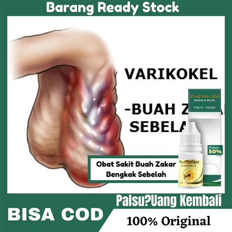 Jual Obat Sakit Buah Zakar Bengkak Sebelah Kanan Kiri Buah Zakar