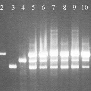 Agarose Gel Electrophoresis Of Multiplex PCR Amplified Products Showing