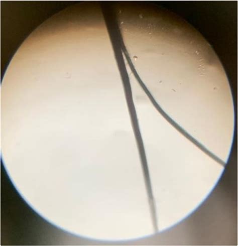 What Do Split Ends Look Like Under A Microscope