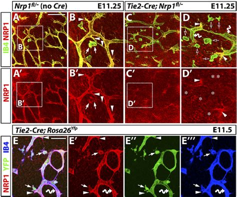 Tie Cre Nrp Fl Mutants Contain Tip Cells That Retain Nrp