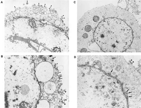 Electron Microscopic Examination Of Sf9 Cells Infected With A