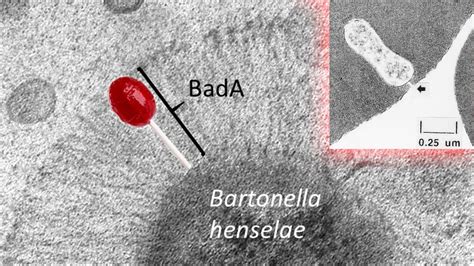 Bartonella infection is associated with neuropsychological symptoms ...