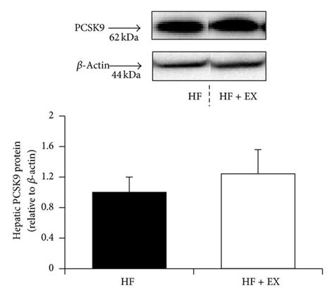 Pcsk Response In C Bl Mice Assigned To A High Fat Hf Or A