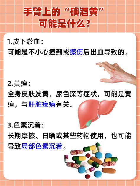 手臂上神秘“碘酒色”？一探究竟，科学应对！ 家庭医生在线家庭医生在线首页频道