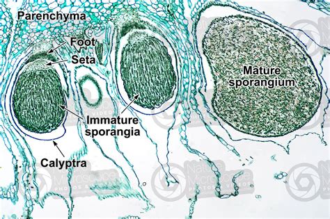 Marchantia Sporophyte Labeled