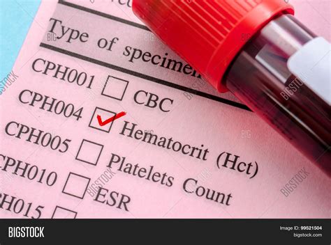 Hematocrit Test Blood Image & Photo (Free Trial) | Bigstock