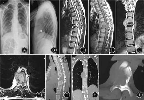 Preoperative Plain Radiograph Magnetic Resonance Imaging And Computed Download Scientific