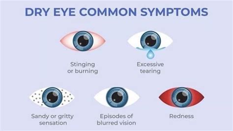 What Is Dry Eye Disease? in Eufaula, AL | Eufaula Eye Associates