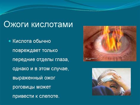 Ожоги глаз - презентация онлайн