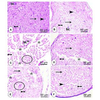 Microscopic Representative Images Of The Sciatic Nerve Transverse