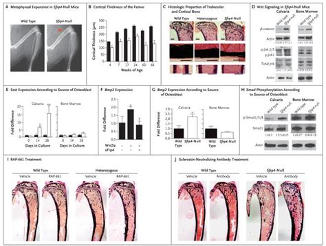 Cortical Bone Fragility Insights From SFRP4 Deficiency In Pyles