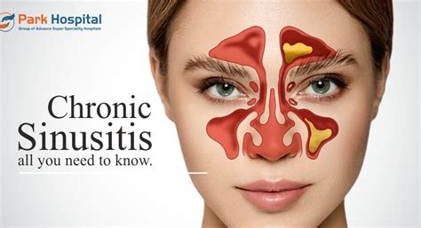 Chronic Sinusitis: Diagnosis and Treatment