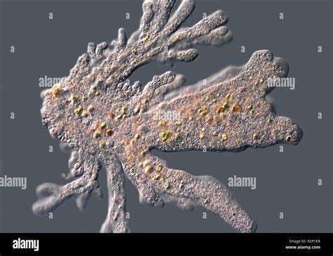 Amoeba Under Microscope X Labeled