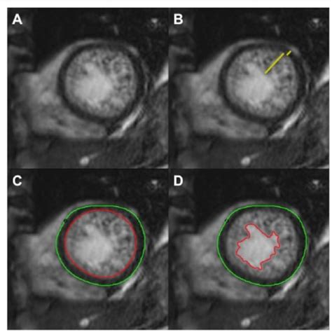 Retrospective Patient Identification Cmr Cardiovascular Magnetic