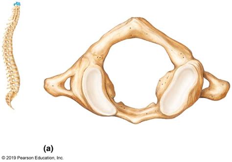 Bone and Bone Markings of the Atlas Diagram | Quizlet